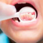 Gum Disease in Kids: What Parents Should Know
